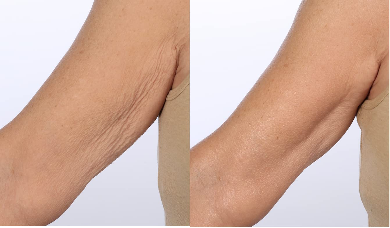 Tratamiento corporal con suero SkinFirm de Nakery Beauty | Piel más firme y de aspect