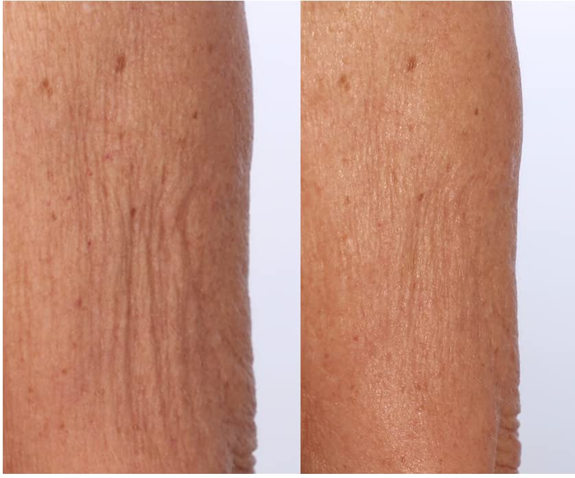 Tratamiento corporal con suero SkinFirm de Nakery Beauty | Piel más firme y de aspect